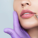 Botox ή υαλουρονικό οξύ; Τι να επιλέξω;
