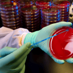 Στρεπτόκοκκος: Τα ύποπτα σημάδια που μας οδηγούν κατευθείαν στον γιατρό