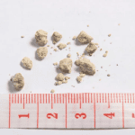 Τα αντιβιοτικά αυξάνουν τον κίνδυνο για πέτρες στα νεφρά κυρίως σε παιδιά και εφήβους