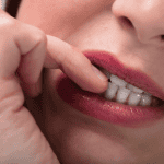 Ονυχοφαγία: πιθανοί κίνδυνοι για τα δόντια και τα ούλα