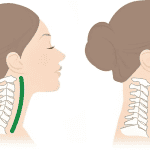 Ευθειασμός αυχένα: Τι είναι, τα Συμπτώματα, οι αιτίες και γιατί η άσκηση είναι «φάρμακο»