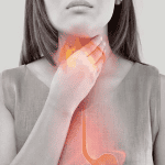 Γαστροοισοφαγική παλινδρόμηση: Οδηγός για μείωση συμπτωμάτων