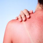 Πώς επηρεάζει το σώμα η παρατεταμένη έκθεση στον ήλιο