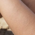 Γιατί παθαίνουμε ανατριχίλα χωρίς να κρυώνουμε