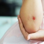 Κάτω από μια μικρή πληγή αρχίζει αμέσως μια σύνθετη διαδικασία επούλωσης