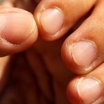 Τι δείχνουν τα νύχια για την υγεία μας και τι δεν μπορούν να αποκαλύψουν